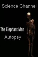 Watch Science Channel Elephant Man Autopsy 123movieshub