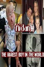 Watch Aidan The Rarest Boy In The World 123movieshub