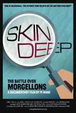 Watch Skin Deep: The Battle Over Morgellons 123movieshub
