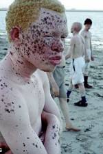 Watch Albino United 123movieshub