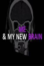 Watch Me & My New Brain 123movieshub