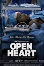 Watch Open Heart 123movieshub