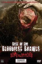 Watch TNA Wrestling: Best of the Bloodiest Brawls - Scars and Stitches 123movieshub