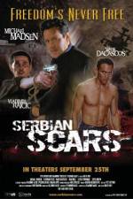 Watch Serbian Scars 123movieshub