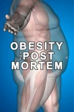 Watch Obesity: The Post Mortem 123movieshub