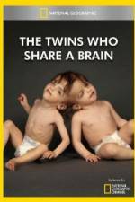 Watch National Geographic The Twins Who Share A Brain 123movieshub