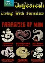 Watch Infested! Living with Parasites 123movieshub