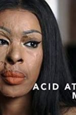 Watch Acid Attack: My Story 123movieshub