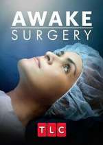 Watch Awake Surgery 123movieshub