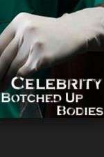 Watch Celebrity Botched Up Bodies 123movieshub